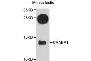 Western blot analysis of extracts of mouse testis, using CRABP1 antibody (ABIN6291540) at 1:3000 dilution. (CRABP1 anticorps)
