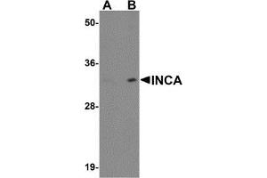 Western blot analysis of INCA1 in EL4 cell lysate with AP30433PU-N INCA1 antibody at (A) 1 and (B) 2 μg/ml. (INCA1 anticorps  (C-Term))