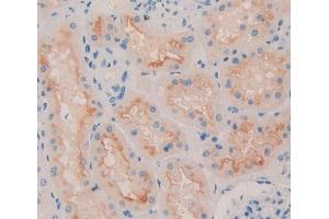 Figure. (QSOX1 anticorps  (AA 394-519))