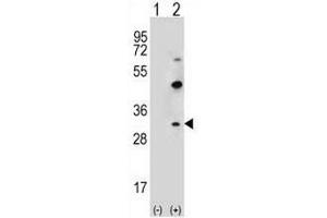 Western blot analysis of CLDN2 (arrow) using rabbit polyclonal CLDN2 Antibody (pTyr195) . (Claudin 2 anticorps  (C-Term))