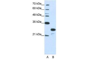 WB Suggested Anti-ANP32A  Antibody Titration: 1. (PHAP1 anticorps  (N-Term))