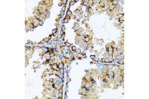 Immunohistochemistry of paraffin-embedded mouse testis using Cortactin Rabbit mAb (ABIN7266511) at dilution of 1:100 (40x lens).