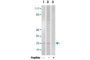 Western blot analysis of extracts from HT-29 cells (Lane 1) and K-562 cells (Lane 2 and lane 3), using HOXA6 polyclonal antibody .