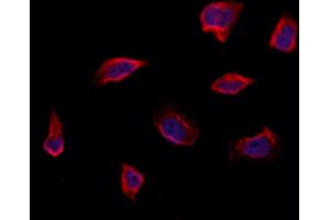 ABIN6264557 and ABIN6273304 staining Hela by IF/ICC.