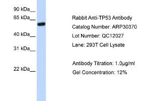 WB Suggested Anti-TP53 Antibody Titration: 0. (p53 anticorps  (N-Term))