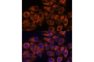 Immunofluorescence analysis of HeLa cells using STE antibody (ABIN7270588) at dilution of 1:100.