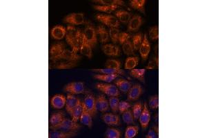 Immunofluorescence analysis of HeLa cells using STE antibody (ABIN7270588) at dilution of 1:100. (STEAP4 anticorps  (AA 1-100))