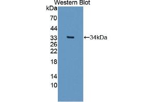 Detection of Recombinant SIRT5, Human using Polyclonal Antibody to Sirtuin 5 (SIRT5) (SIRT5 anticorps  (AA 37-310))
