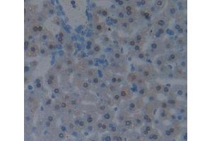 Used in DAB staining on fromalin fixed paraffin- embedded liver tissue (CBY1/PGEA1 anticorps  (AA 7-127))