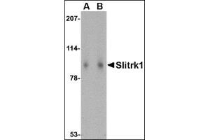 Western blot analysis of Slitrk1 in human brain tissue lysate with this product at (A) 1 and (B) 2 μg/ml.