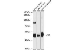 Western blot analysis of extracts of various cell lines using CKB Polyclonal Antibody at dilution of 1:3000. (CKB anticorps)