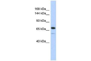 WB Suggested Anti-CALD1 Antibody Titration:  0. (Caldesmon anticorps  (Middle Region))
