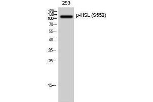 Western Blotting (WB) image for anti-Lipase, Hormone-Sensitive (LIPE) (pSer552) antibody (ABIN3182522) (LIPE anticorps  (pSer552))