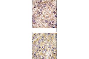 Image no. 2 for anti-Phosphatidylinositol 4-Kinase Type 2 beta (PI4K2B) (N-Term) antibody (ABIN360473)