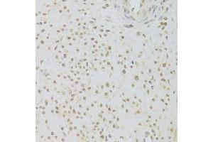 Immunohistochemistry of paraffin-embedded human leiomyoma of uterus using PRPF3 Antibody. (PRPF3 anticorps  (AA 1-280))