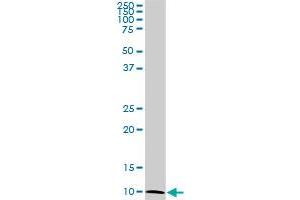 ATP6V1G2 monoclonal antibody (M02), clone 2E11.