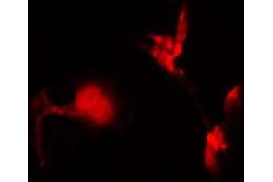 ABIN6272427 staining 293 by IF/ICC. (Separase anticorps  (Internal Region))
