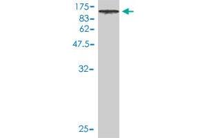 Western Blot detection against Immunogen (90. (DNAI2 anticorps  (AA 1-593))