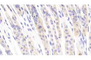 Detection of CCL1 in Mouse Stomach Tissue using Polyclonal Antibody to Chemokine C-C-Motif Ligand 1 (CCL1) (CCL1 anticorps  (AA 24-92))