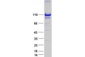 Validation with Western Blot
