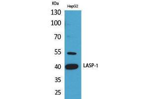 Western Blotting (WB) image for anti-LIM and SH3 Protein 1 (LASP1) (Internal Region) antibody (ABIN3178265) (LASP1 anticorps  (Internal Region))