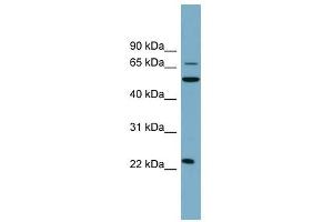 CLEC6A antibody used at 1 ug/ml to detect target protein.