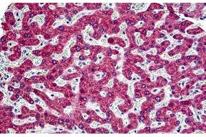 Human Liver: Formalin-Fixed, Paraffin-Embedded (FFPE)