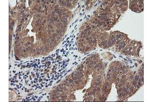 Image no. 2 for anti-Ras Homolog Gene Family, Member J (RHOJ) antibody (ABIN1501341)