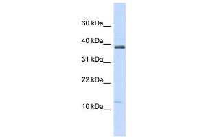 SPINK1 antibody used at 1 ug/ml to detect target protein. (SPINK1 anticorps  (N-Term))