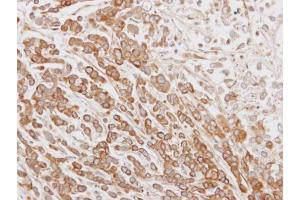 IHC-P Image Immunohistochemical analysis of paraffin-embedded MDA-MB468 xenograft, using NYD-SP26, antibody at 1:100 dilution. (CABS1 anticorps  (Center))