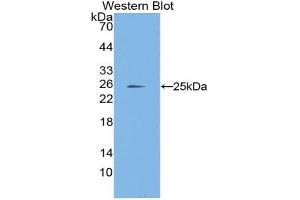 Western blot analysis of the recombinant protein. (Laminin alpha 1 anticorps  (AA 41-230))