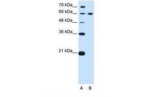 Image no. 1 for anti-Deltex Homolog 2 (DTX2) (AA 454-503) antibody (ABIN6739165) (DTX2 anticorps  (AA 454-503))