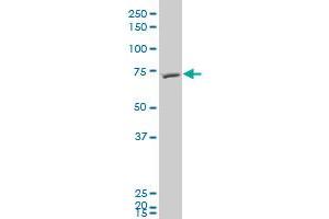 FBXL5 polyclonal antibody (A01), Lot # 051123JCS1 Western Blot analysis of FBXL5 expression in HepG2 .