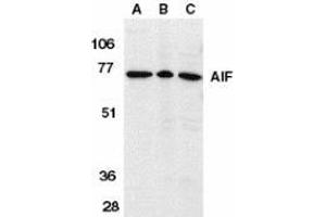 Western blot analysis of AIF in K562 cell lysate (A), rat heart (B), and mouse heart (C) tissue lysates with AP30030PU-N AIF antibody (IN) at 1 μg/ml. (AIF anticorps  (Intermediate Domain))