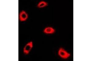 Immunofluorescent analysis of AK4 staining in A549 cells. (AK4 anticorps)