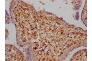 IHC image of ABIN7127602 diluted at 1:100 and staining in paraffin-embedded human placenta tissue performed on a Leica BondTM system.