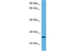 Host:  Rabbit  Target Name:  GSTA5  Sample Tissue:  Human Hela Whole Cell  Antibody Dilution:  1ug/ml (GSTa5 anticorps  (Middle Region))