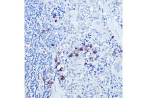 Immunohistochemistry of paraffin-embedded rat spleen using TLR9 Rabbit pAb (ABIN7270849) at dilution of 1:100 (40x lens).