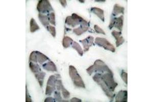 Immunohistochemistry (IHC) image for anti-Desmin (DES) (AA 421-470) antibody (ABIN2889184) (Desmin anticorps  (AA 421-470))
