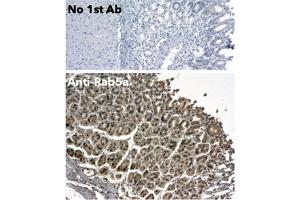 Immunohistochemistry (IHC) image for anti-RAB5A, Member RAS Oncogene Family (RAB5A) (C-Term) antibody (ABIN1439994)