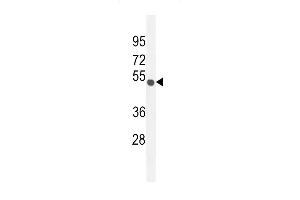 Western blot analysis in mouse Neuro-2a cell line lysates (35ug/lane). (CO027 (AA 503-531), (C-Term) anticorps)