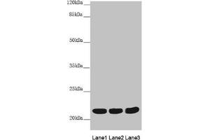 Western blot All lanes: MYL3 antibody at 3. (MYL3/CMLC1 anticorps  (AA 1-195))