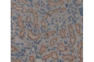 Used in DAB staining on fromalin fixed paraffin- embedded kidney tissue
