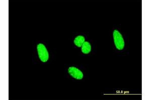 Immunofluorescence of monoclonal antibody to SCML1 on HeLa cell.