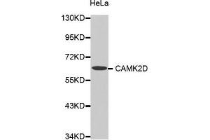 Western Blotting (WB) image for anti-Calcium/calmodulin-Dependent Protein Kinase II delta (CAMK2D) (AA 1-260) antibody (ABIN6213921) (CAMK2D anticorps  (AA 1-260))