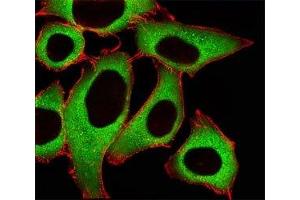 Fluorescent image of A549 cells stained with ALDH1A1 antibody at 1:25. (ALDH1A1 anticorps  (AA 306-339))