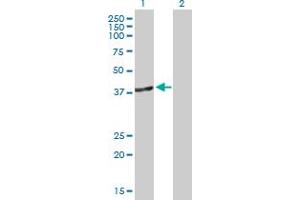 Western Blot analysis of DNMT3L expression in transfected 293T cell line by DNMT3L MaxPab polyclonal antibody. (DNMT3L anticorps  (AA 1-386))
