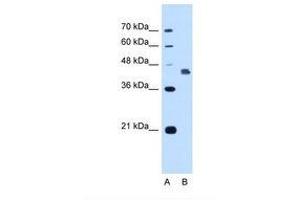 DFNA5 Antikörper  (AA 342-391)