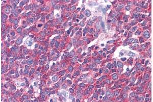 Human Tonsil: Formalin-Fixed, Paraffin-Embedded (FFPE) (LMTK2 anticorps  (AA 1181-1280))