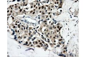 Immunohistochemical staining of paraffin-embedded thyroid tissue using anti-CAMK1Dmouse monoclonal antibody. (CAMK1D anticorps)